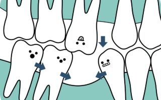 歯がない時の3つの治療法とそのまま放置した時の影響について