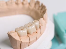 被せ物が痛い原因は？痛みの症状と対処法も解説