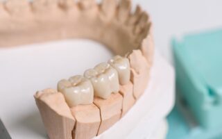 被せ物が痛い原因は？痛みの症状と対処法も解説